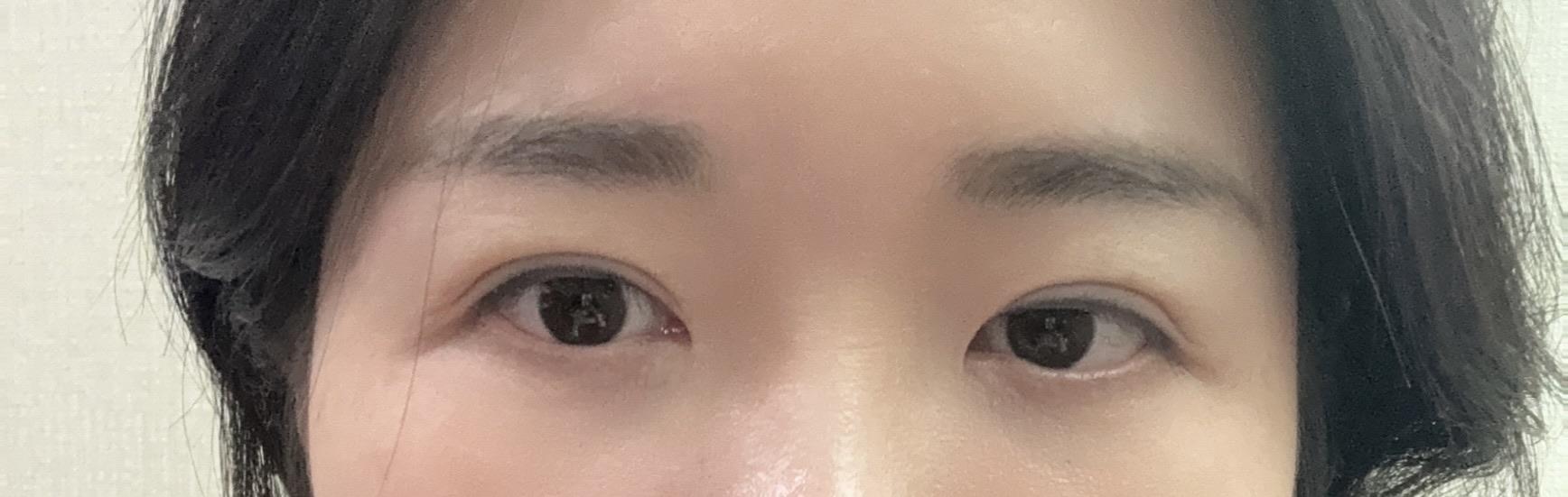 後