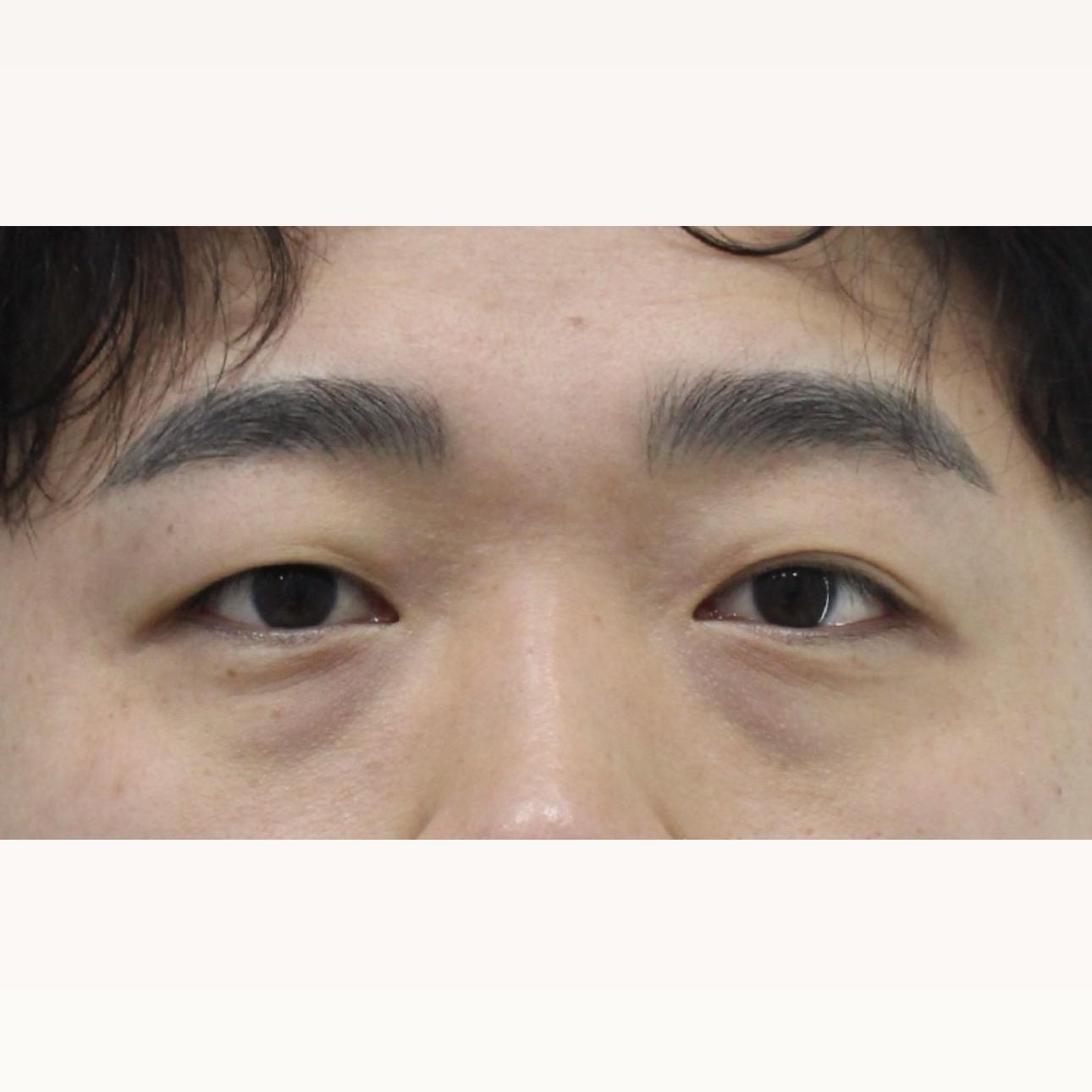 後