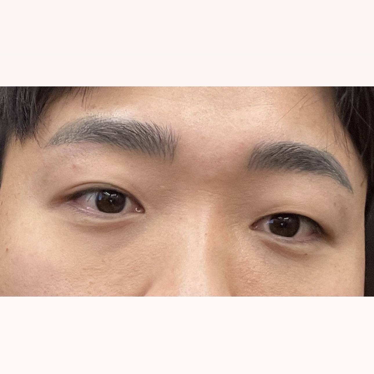 後