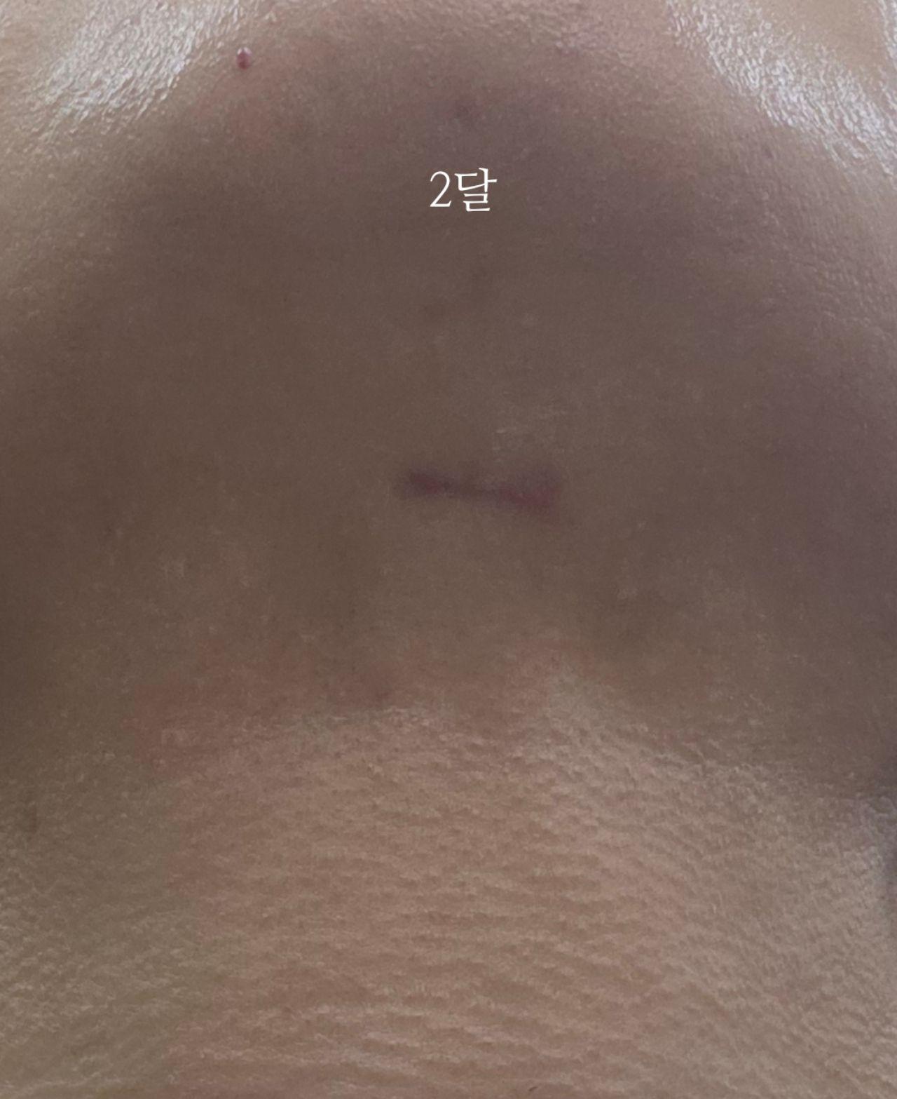 後