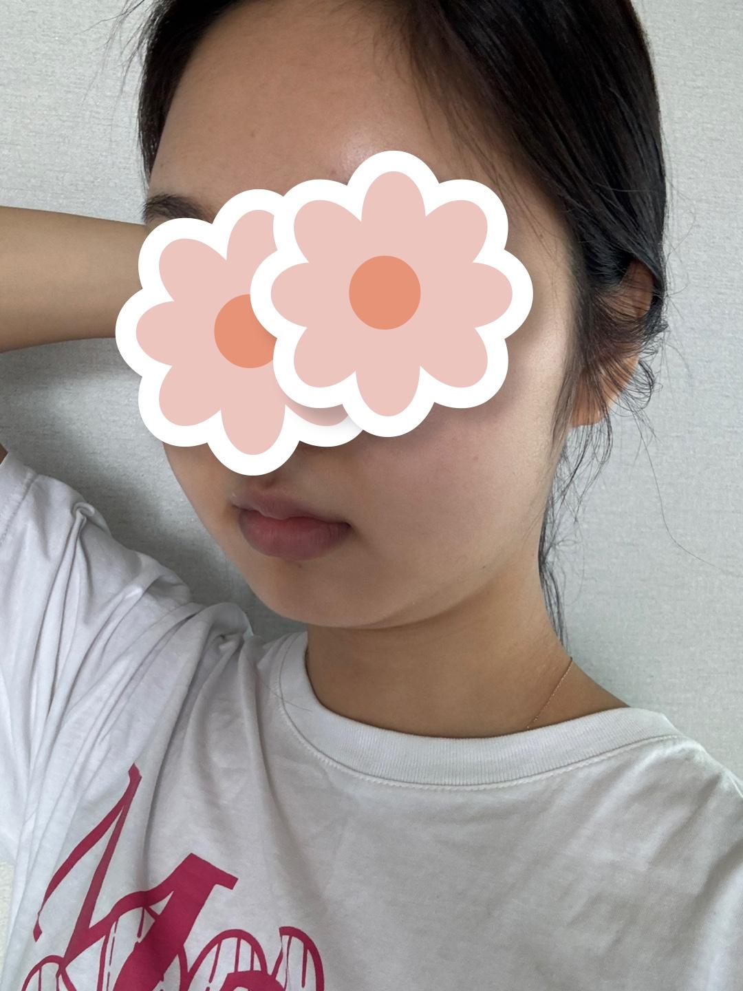 後