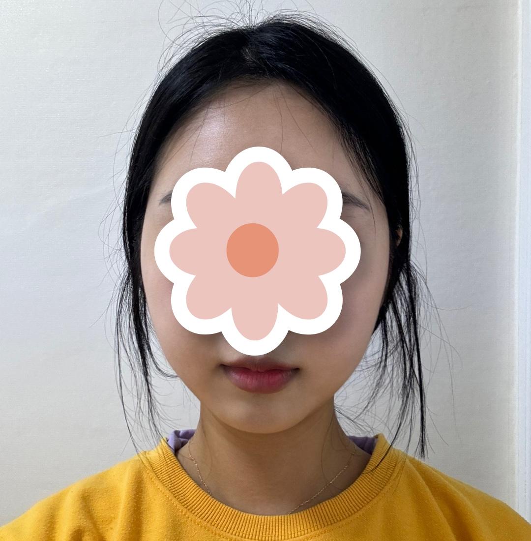 後