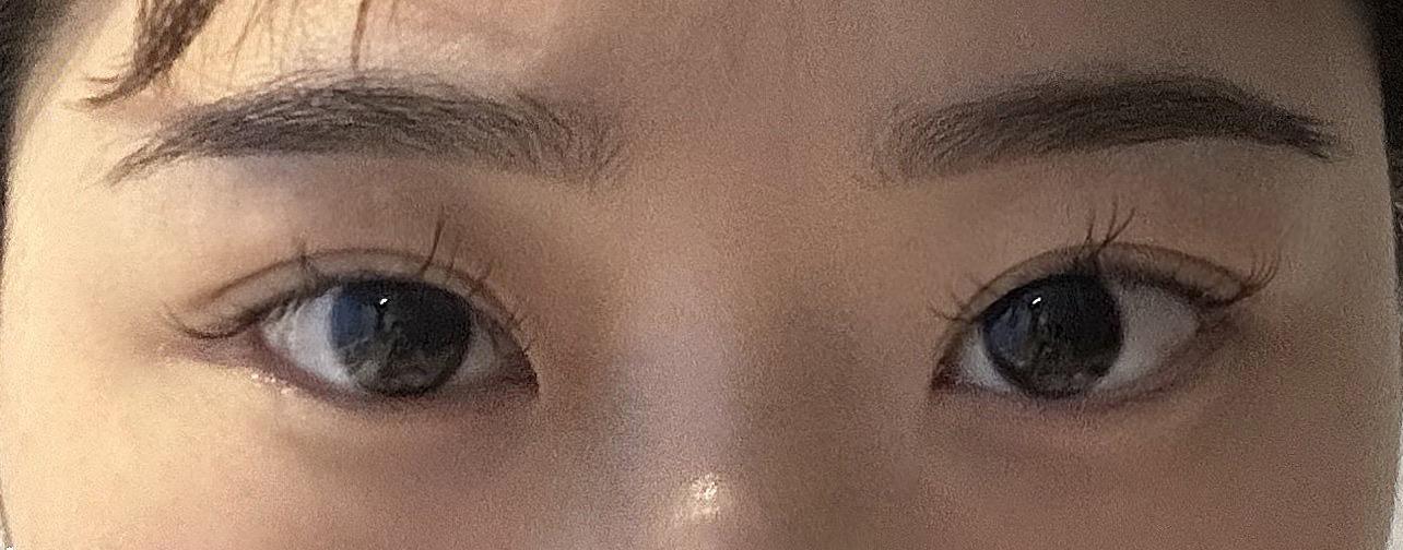 後