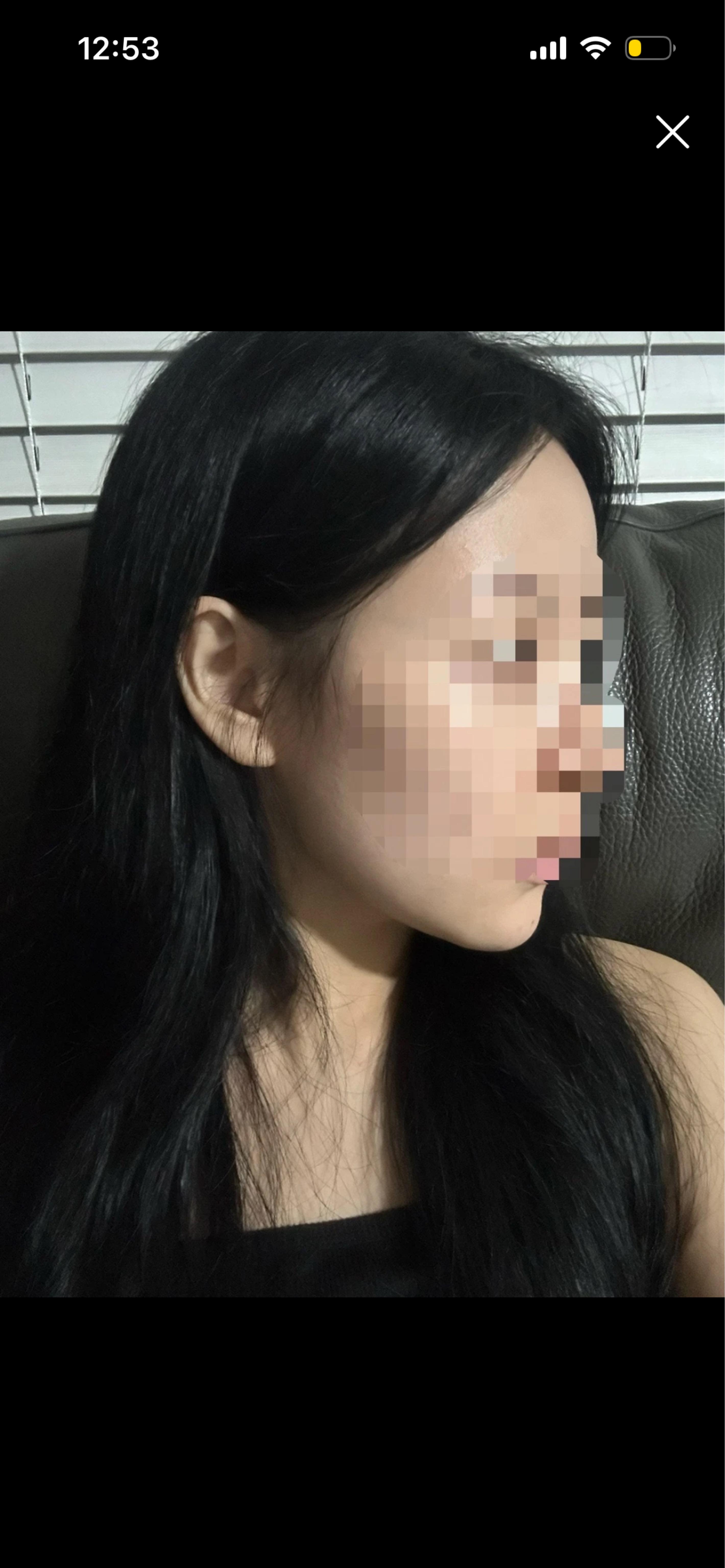 後