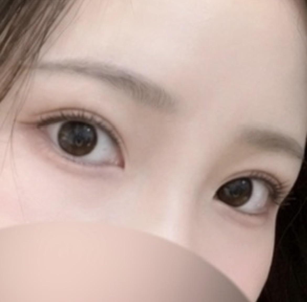 後