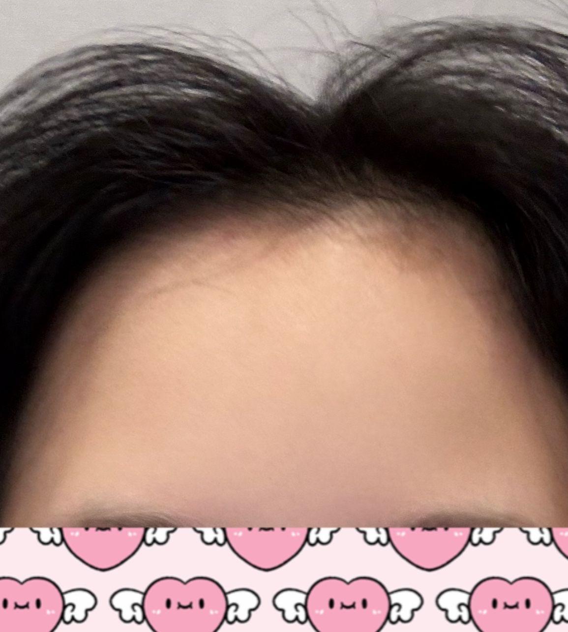 後