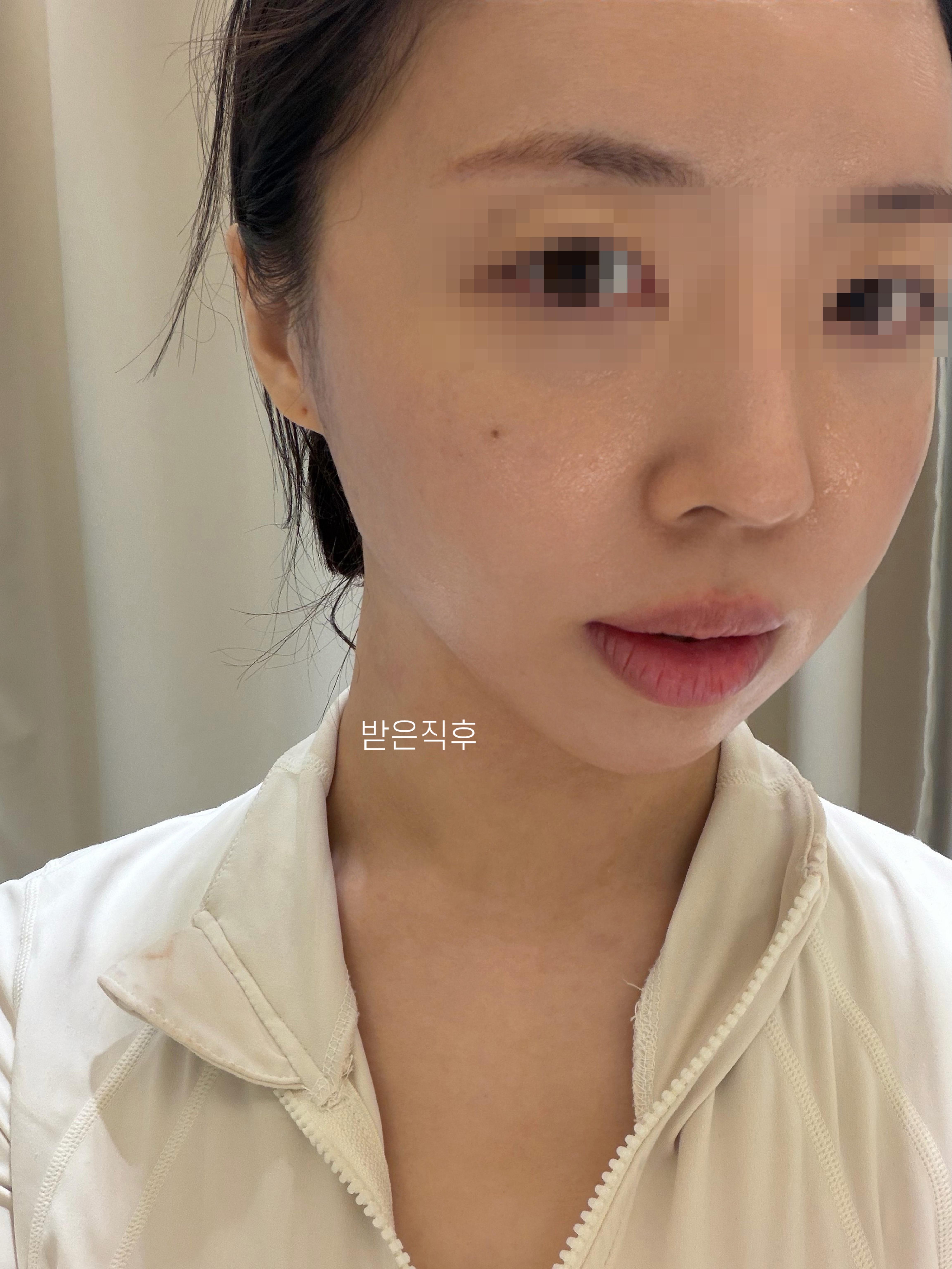 後