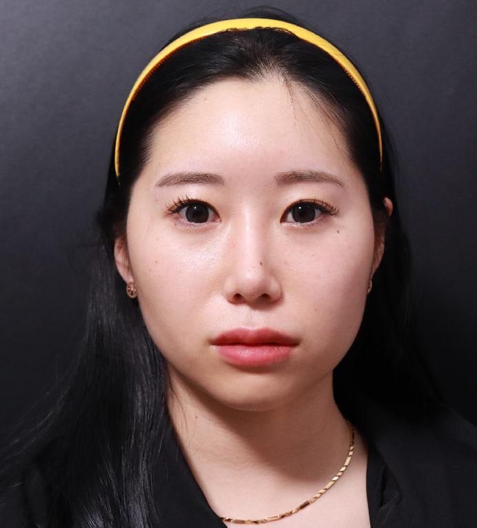 後