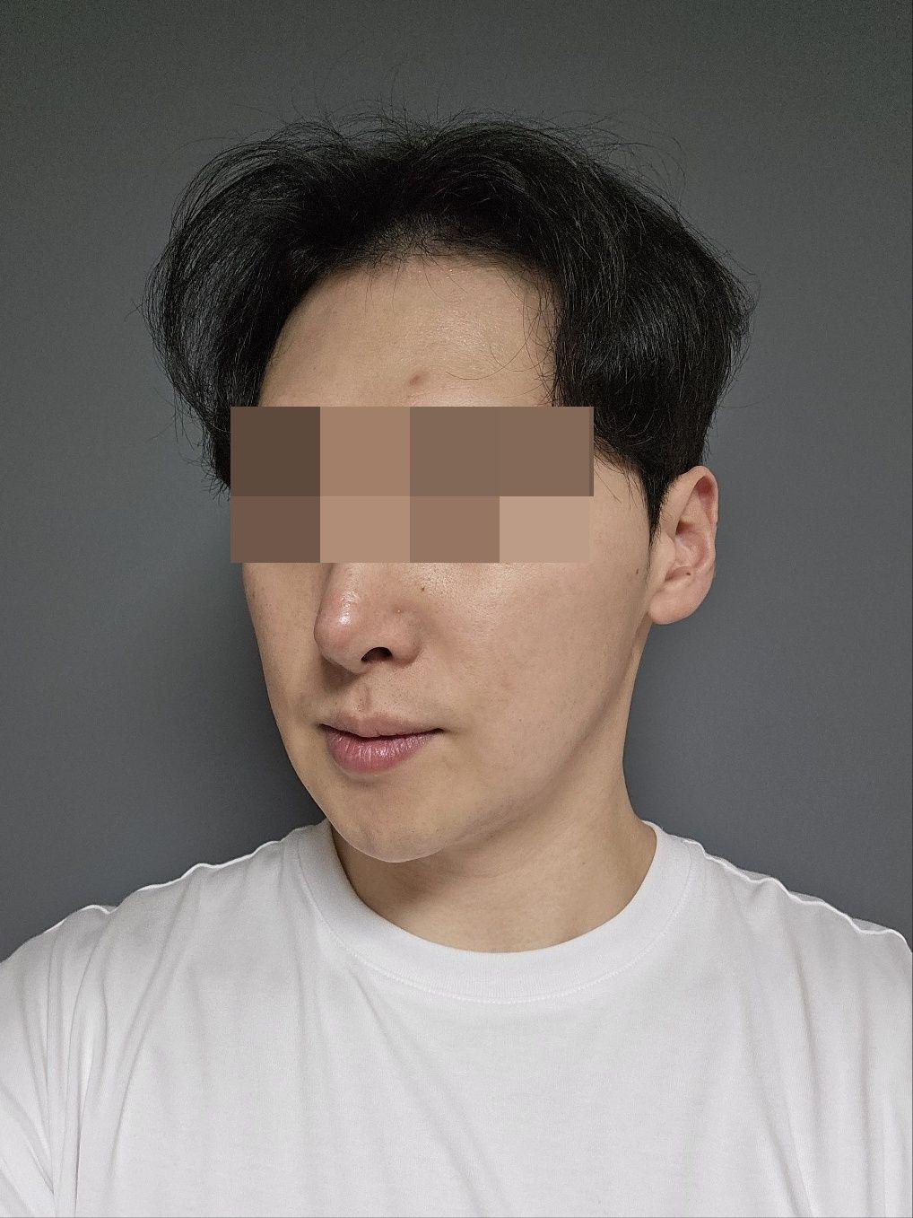 後