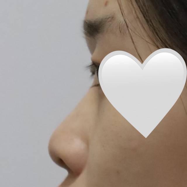 後