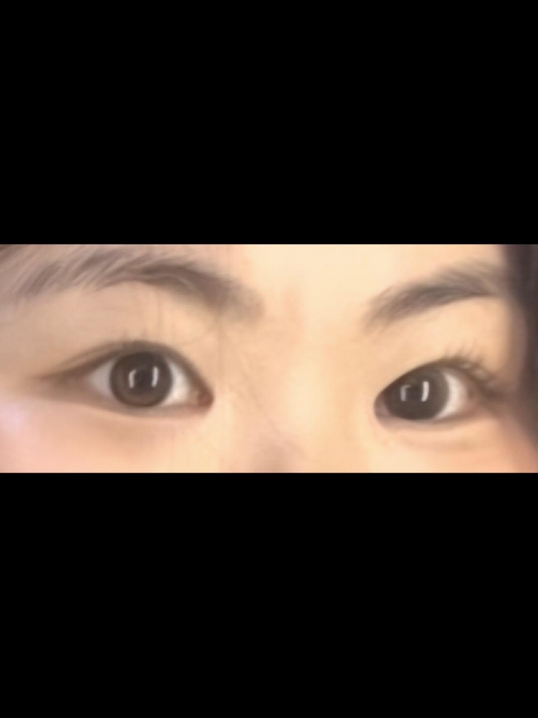 後