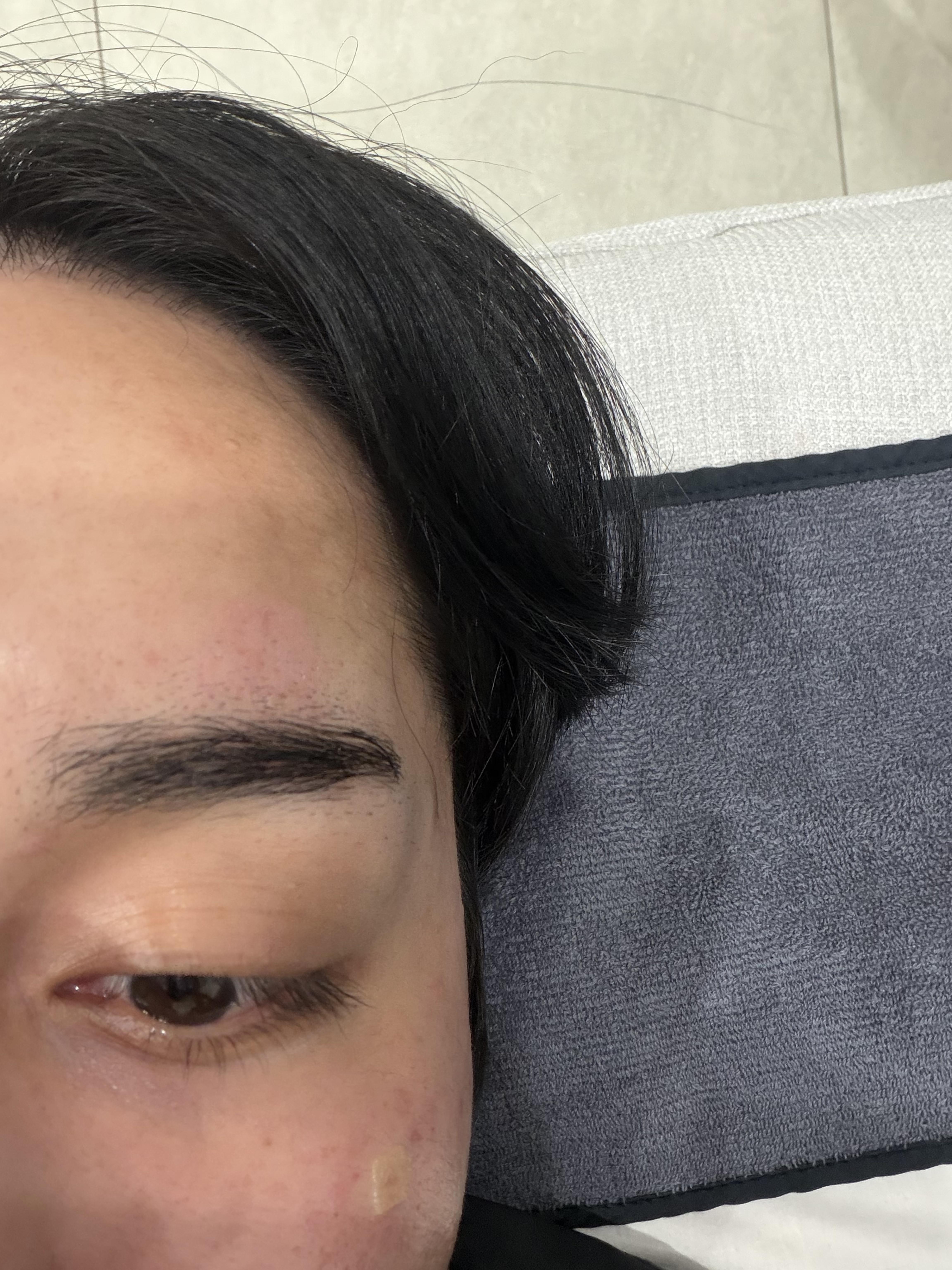 後