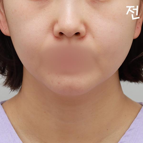後