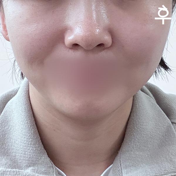 後