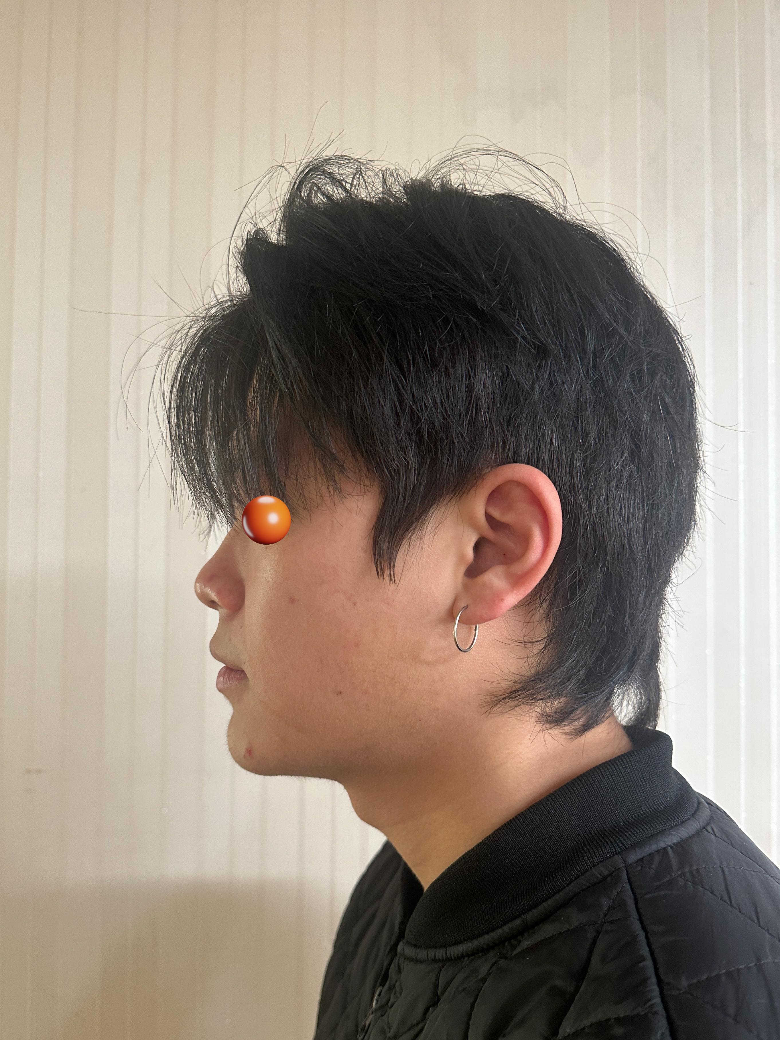 後