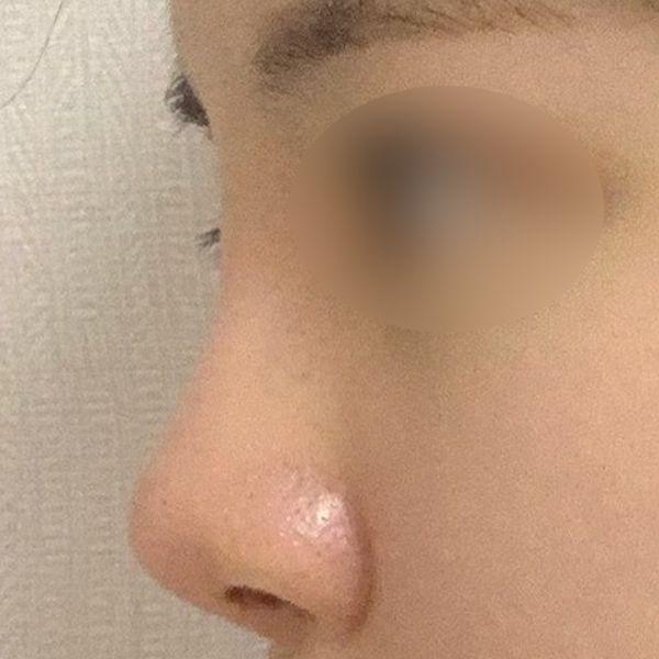 前