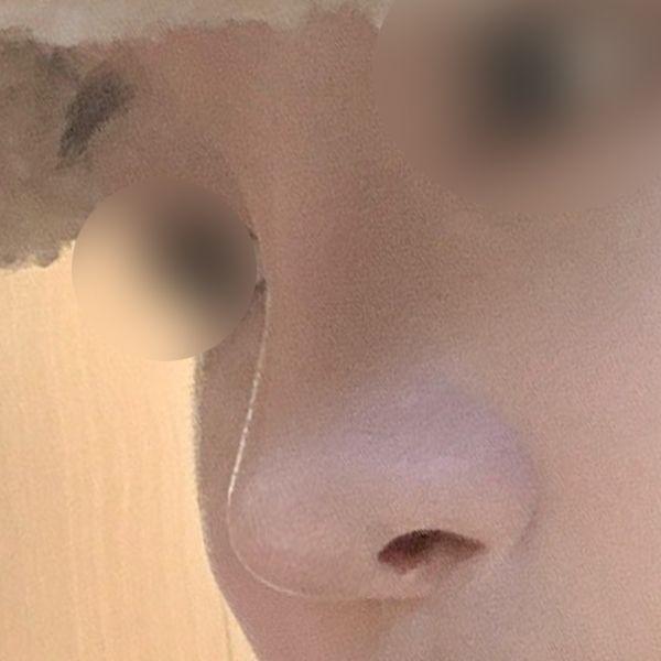 后