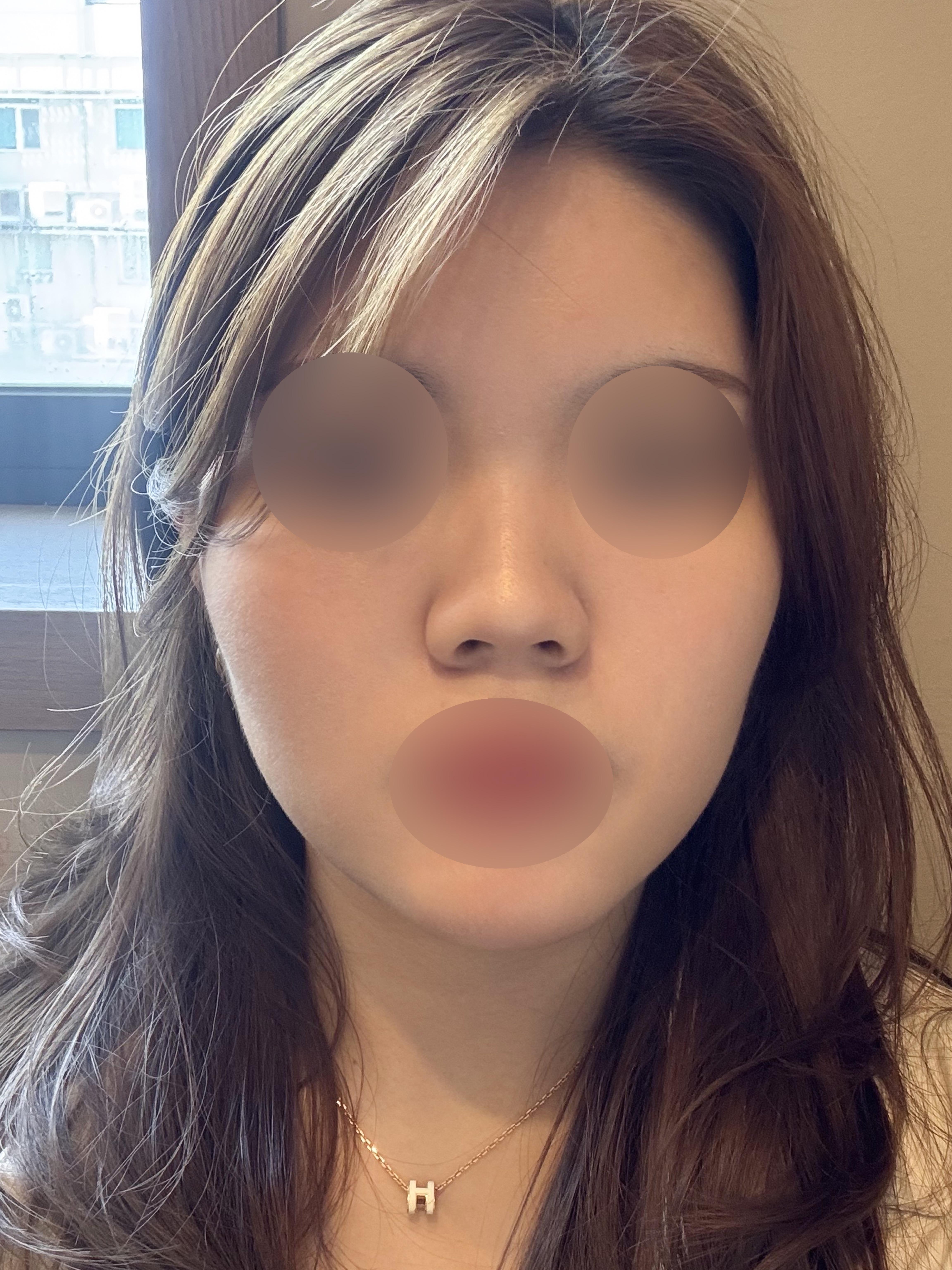 後