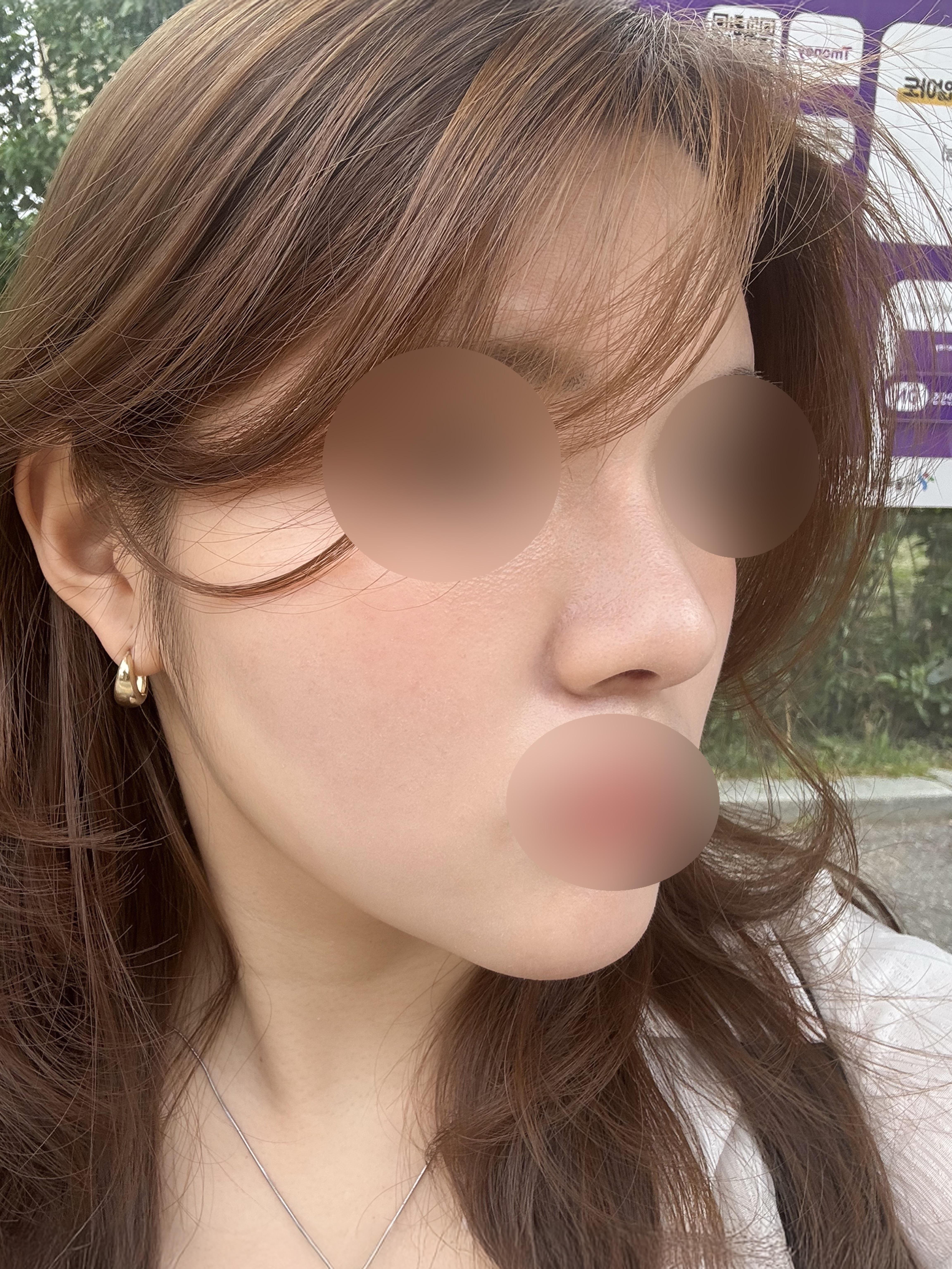 後