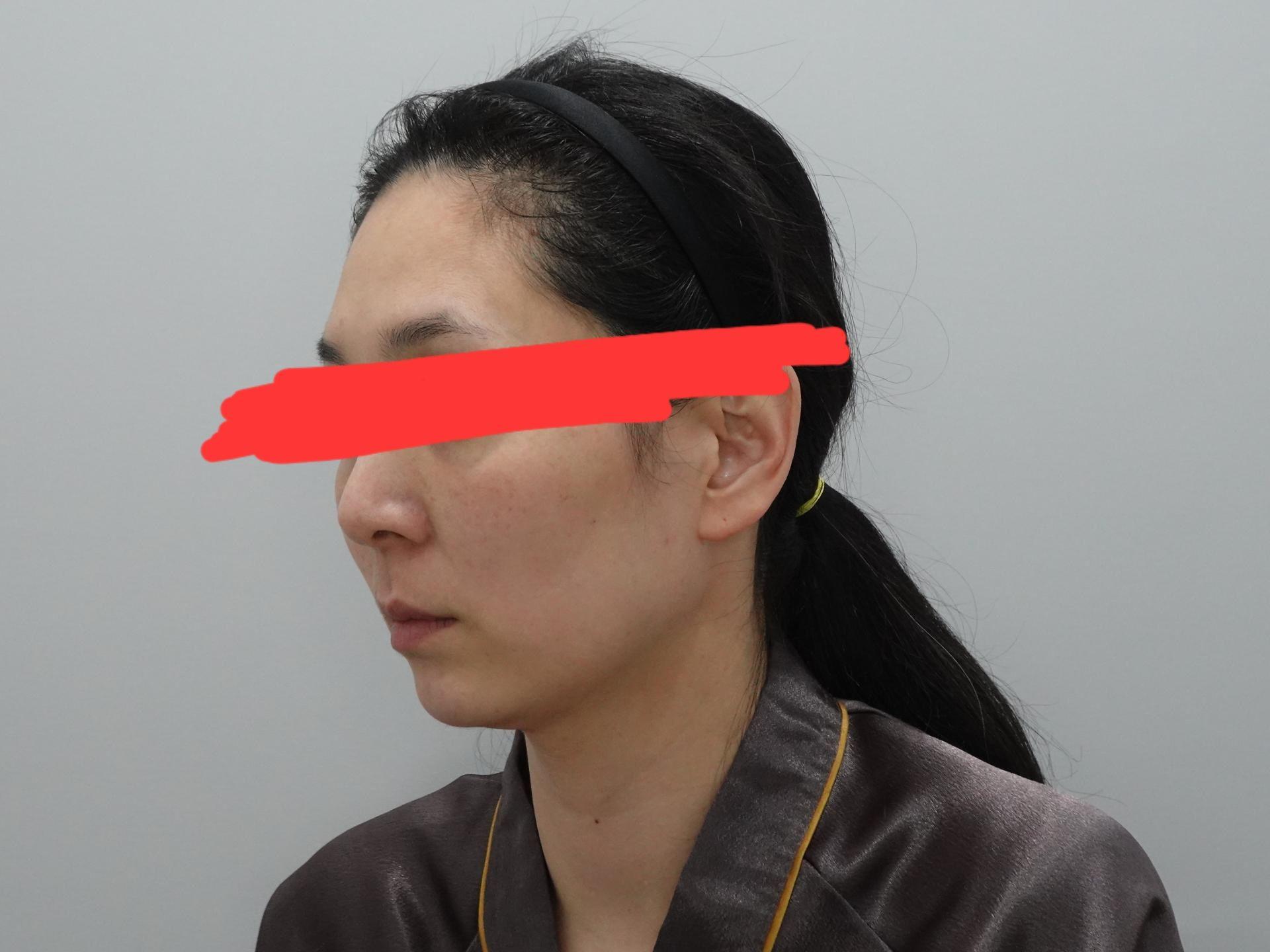 後