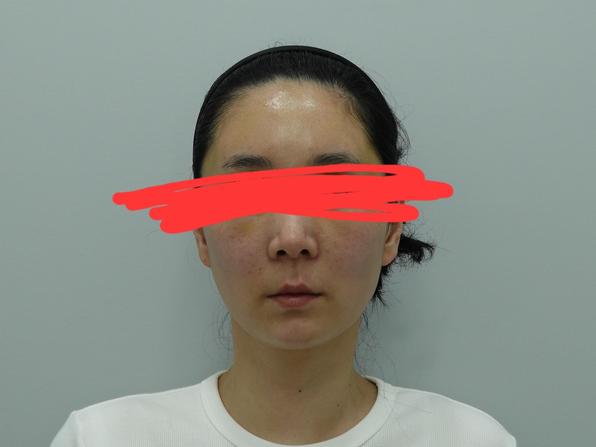 後