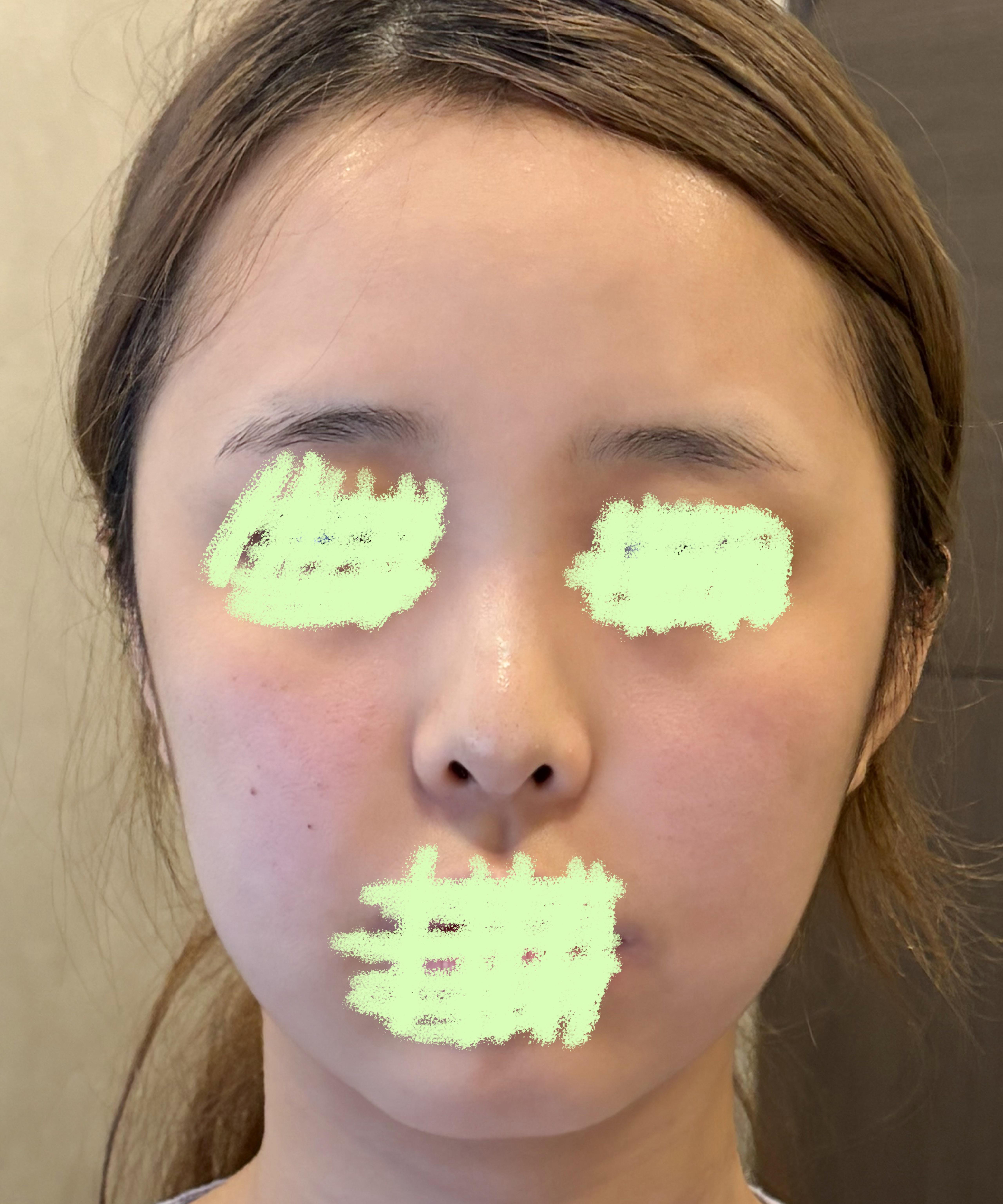 後