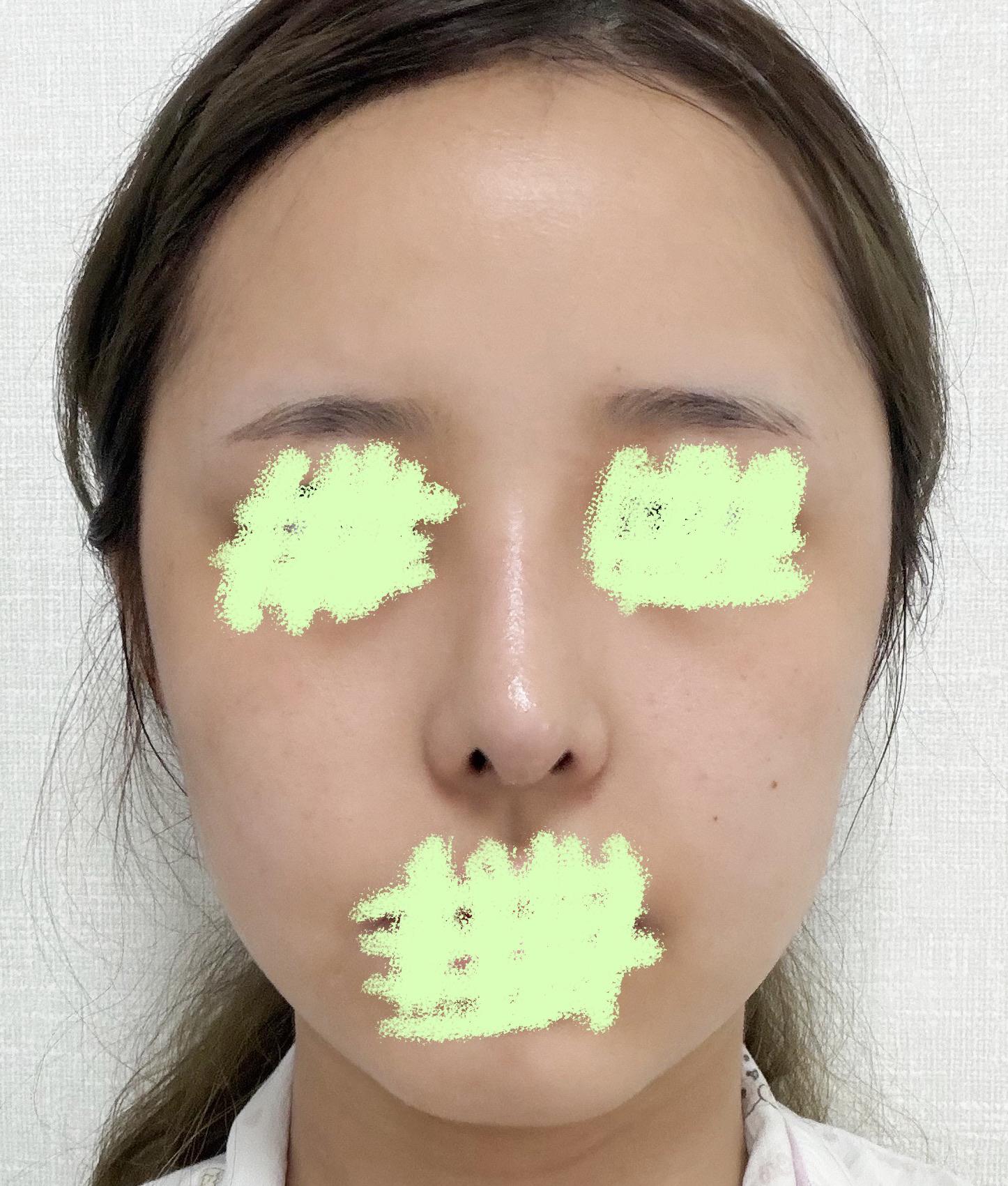 後