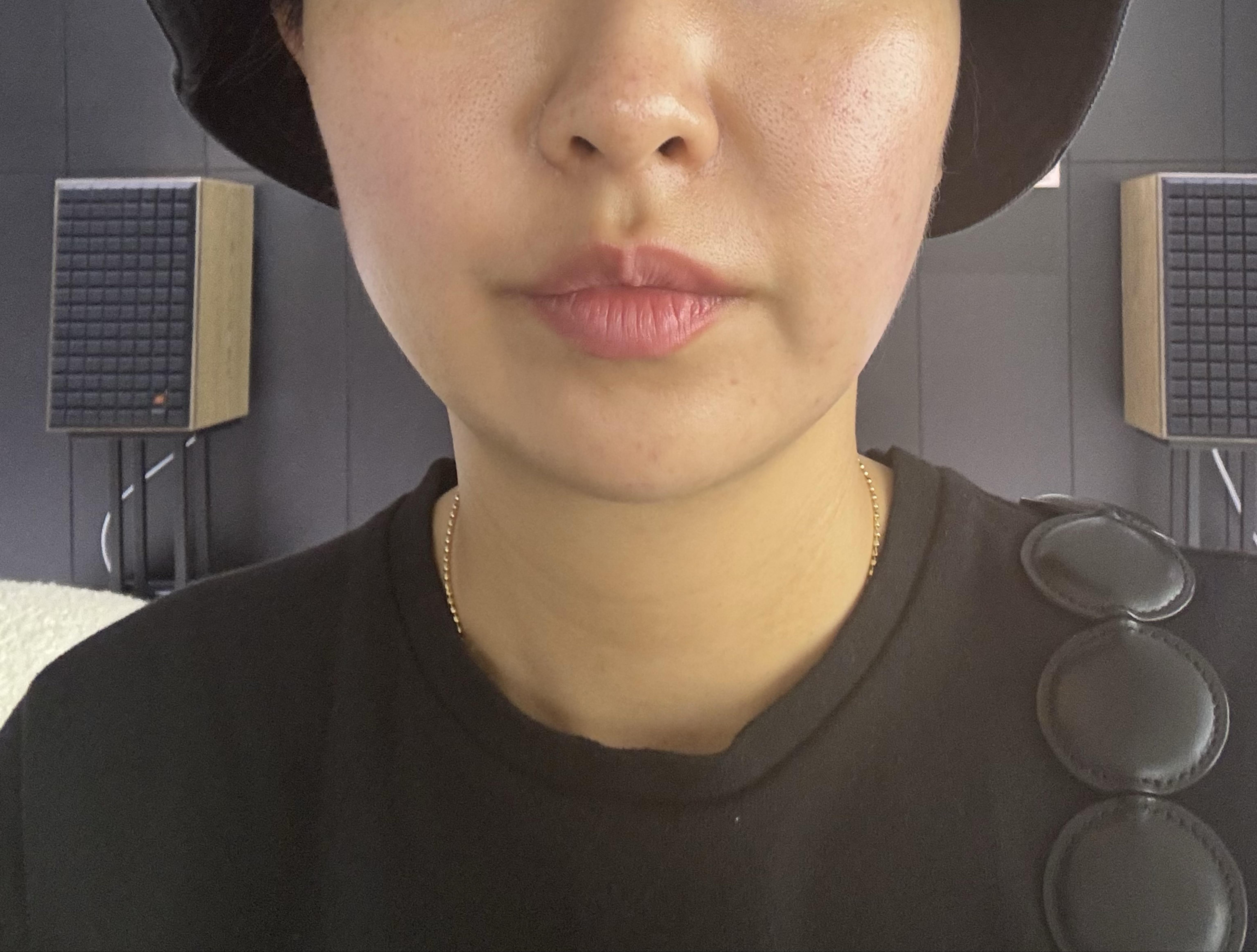 後