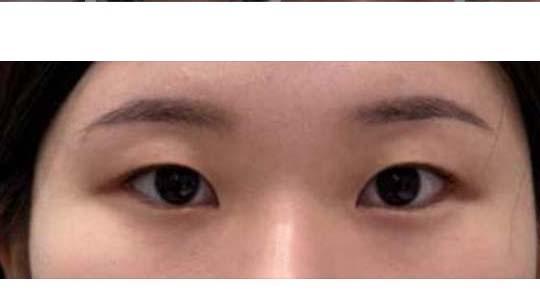 後