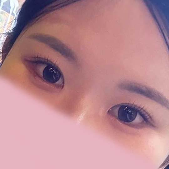 後