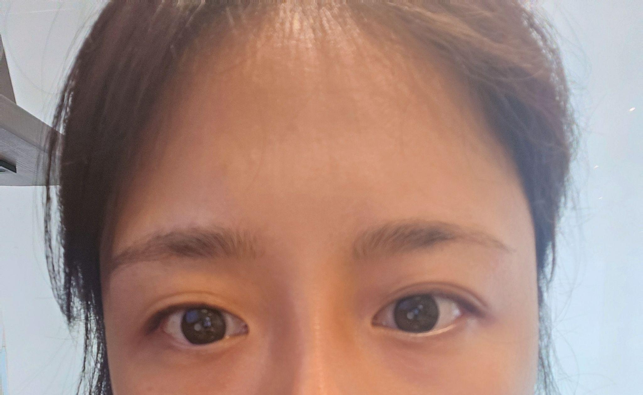 後