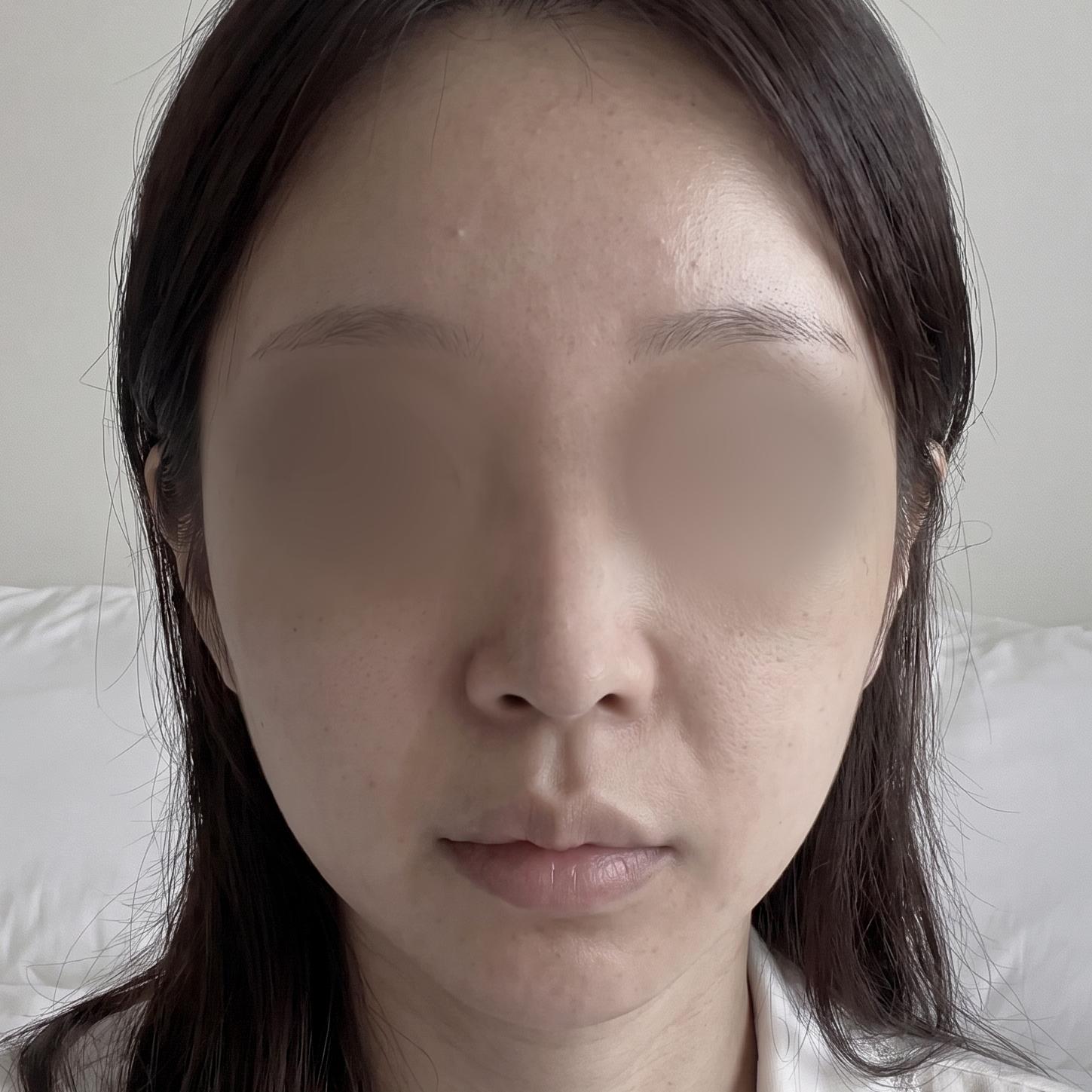後