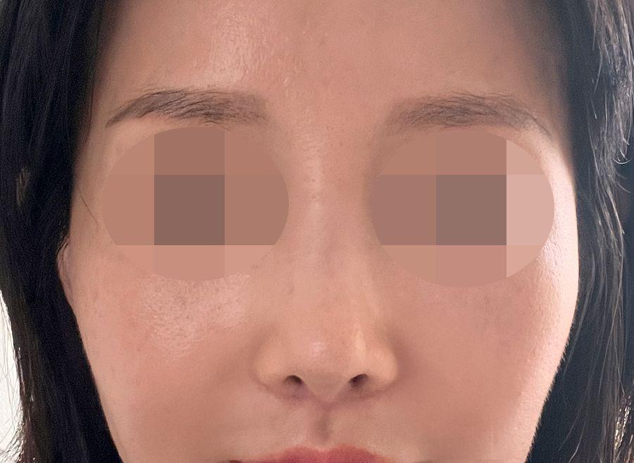 後