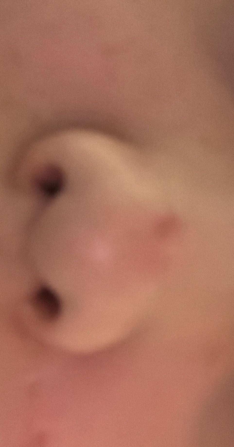 後