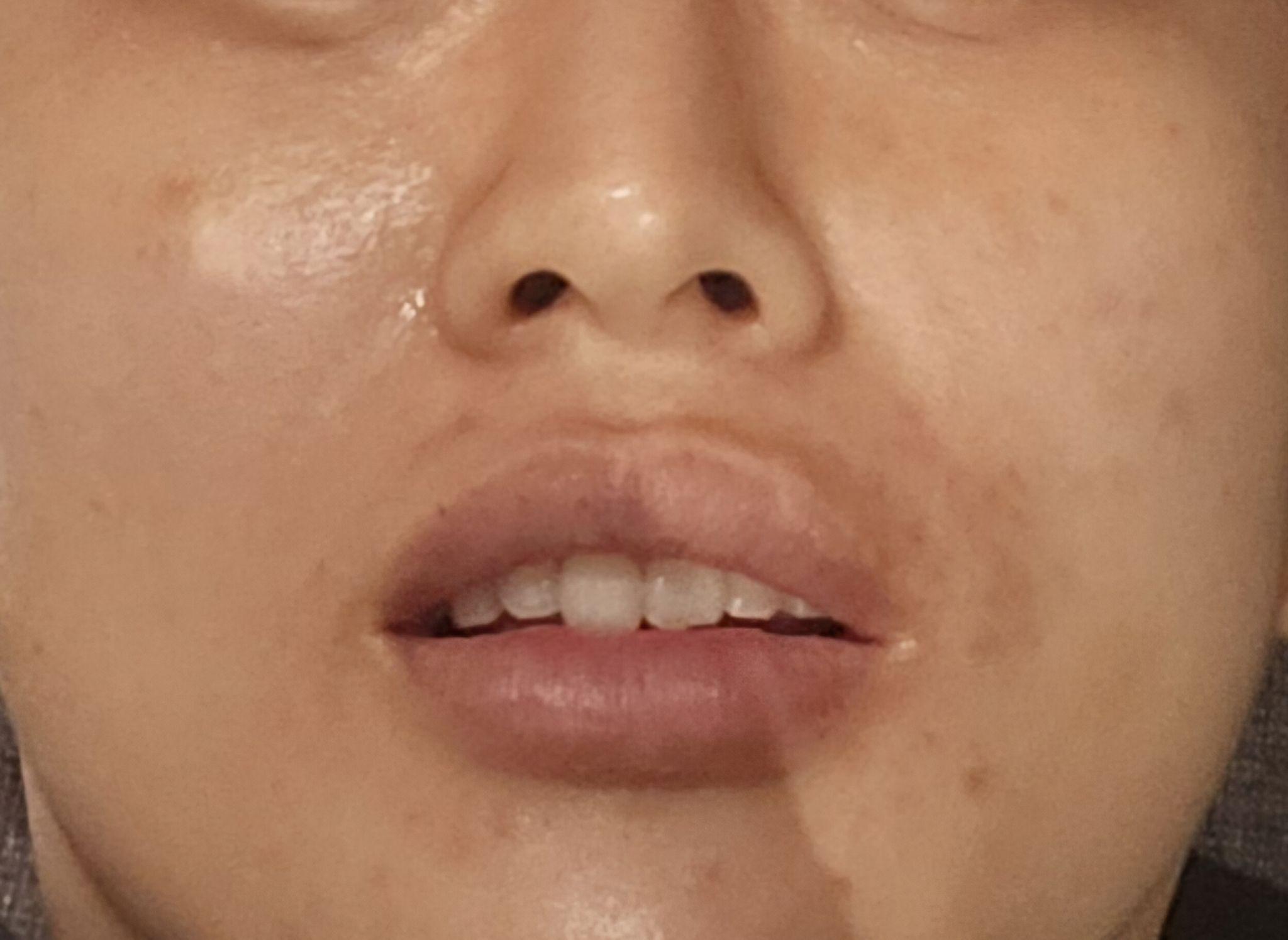 後