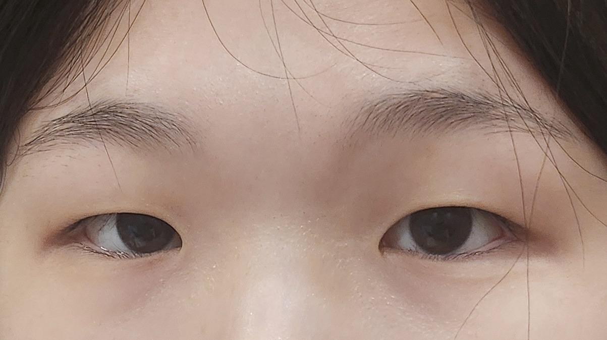 後