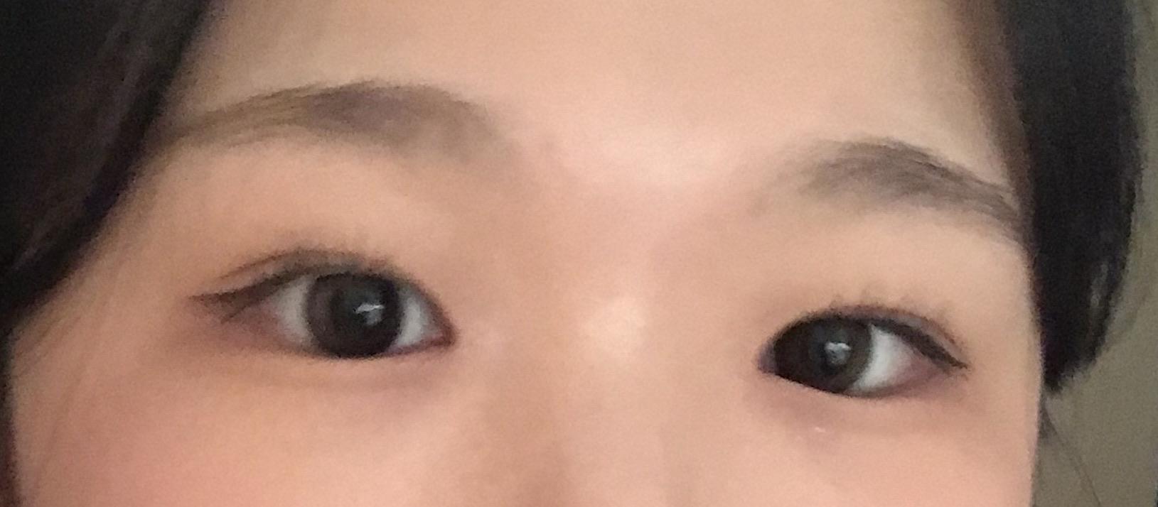 後