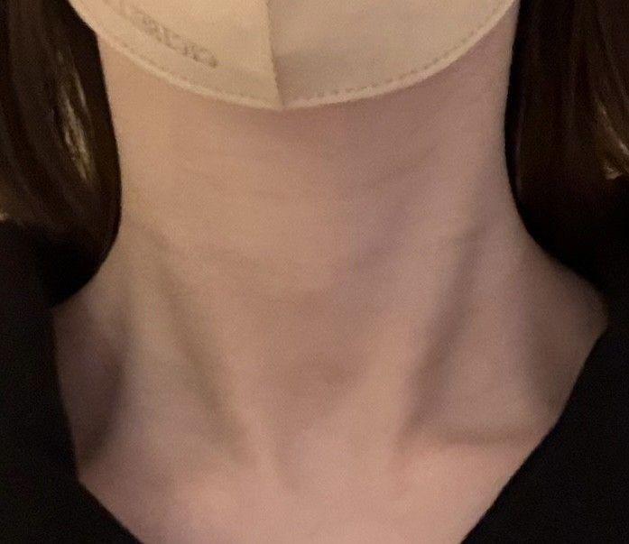 前