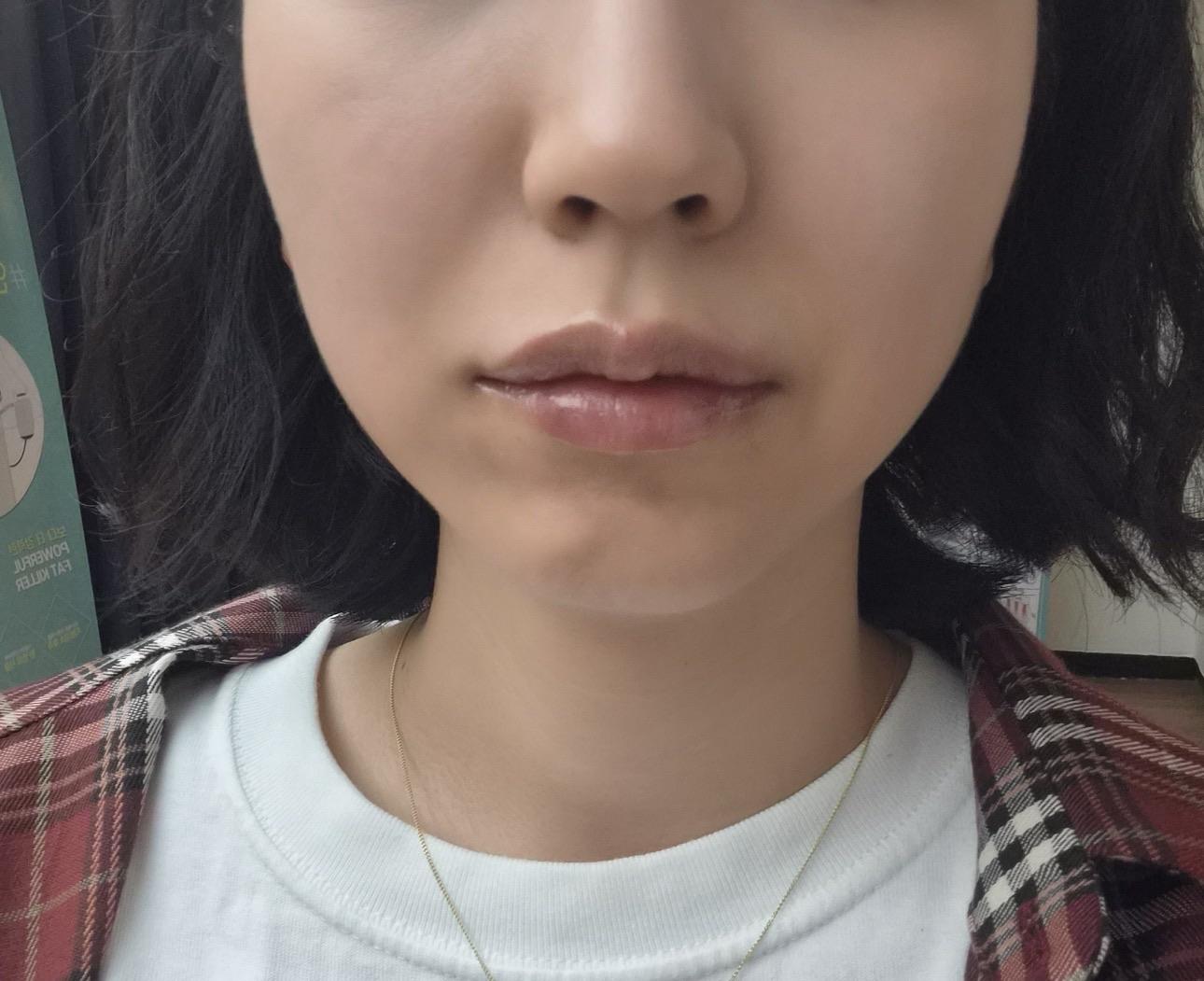 後