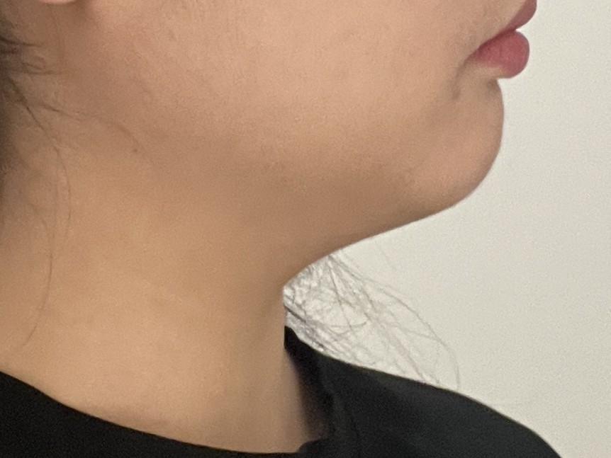 後