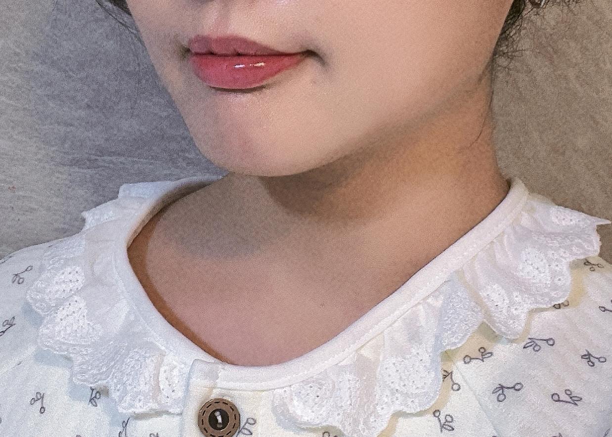 後