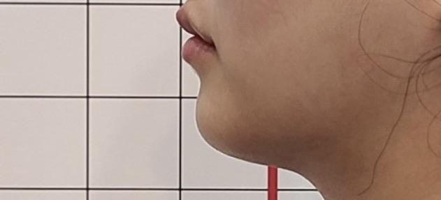 後