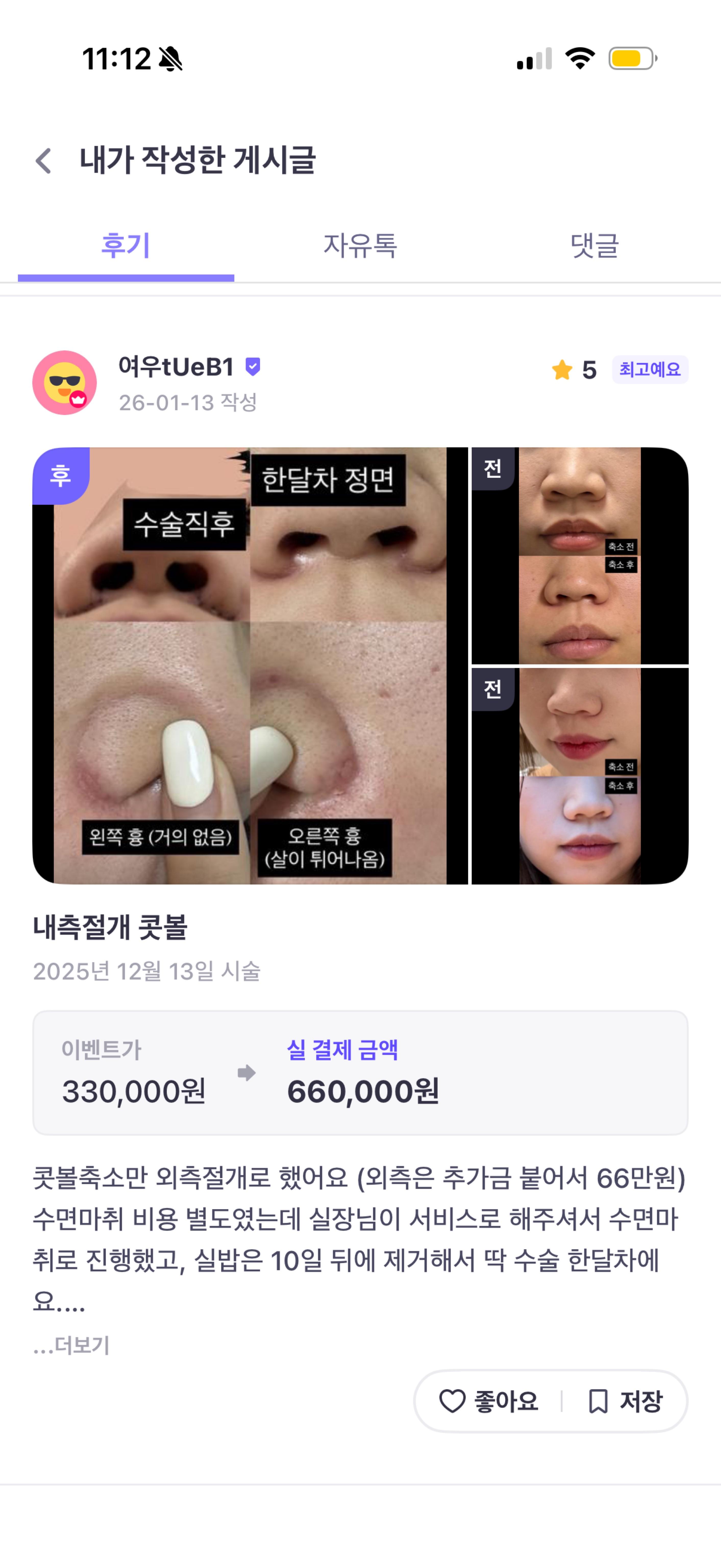 後