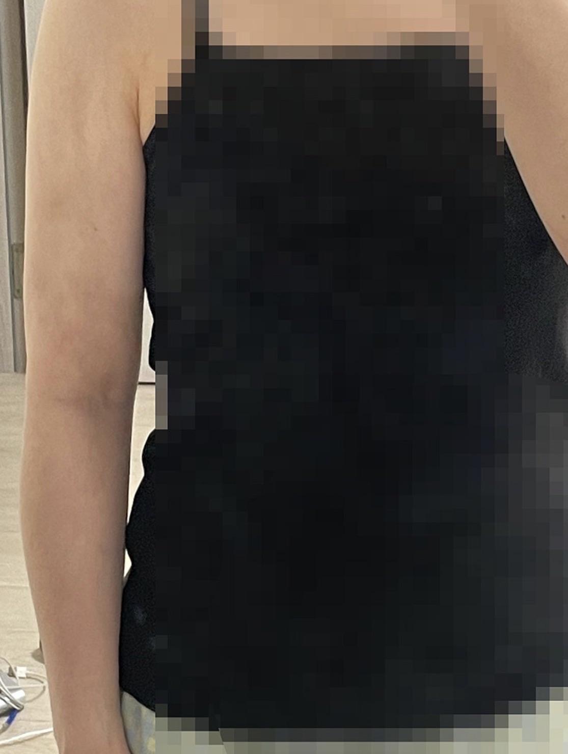 後