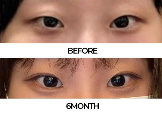 后