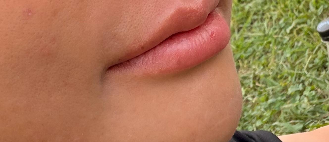 After