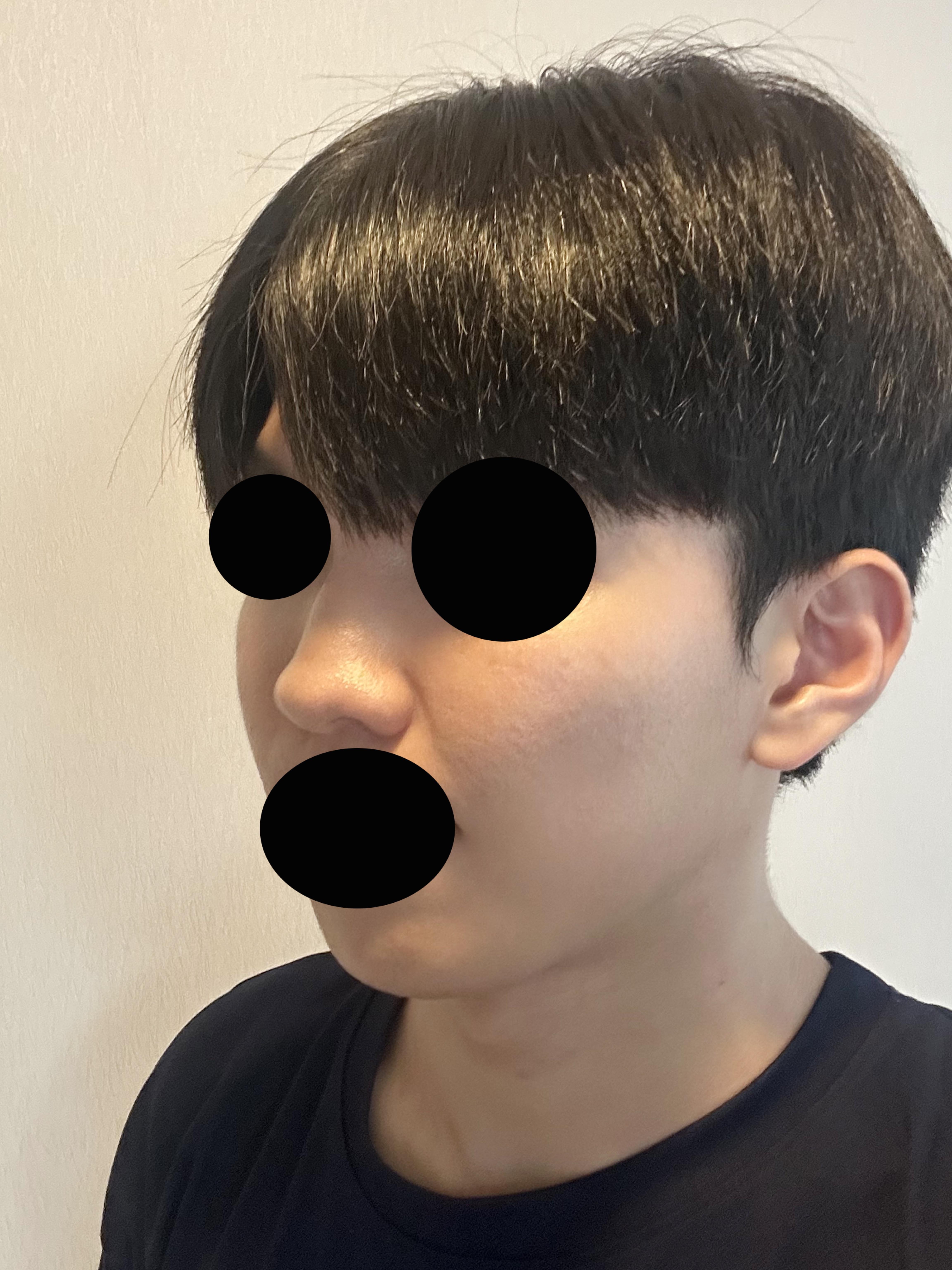 後