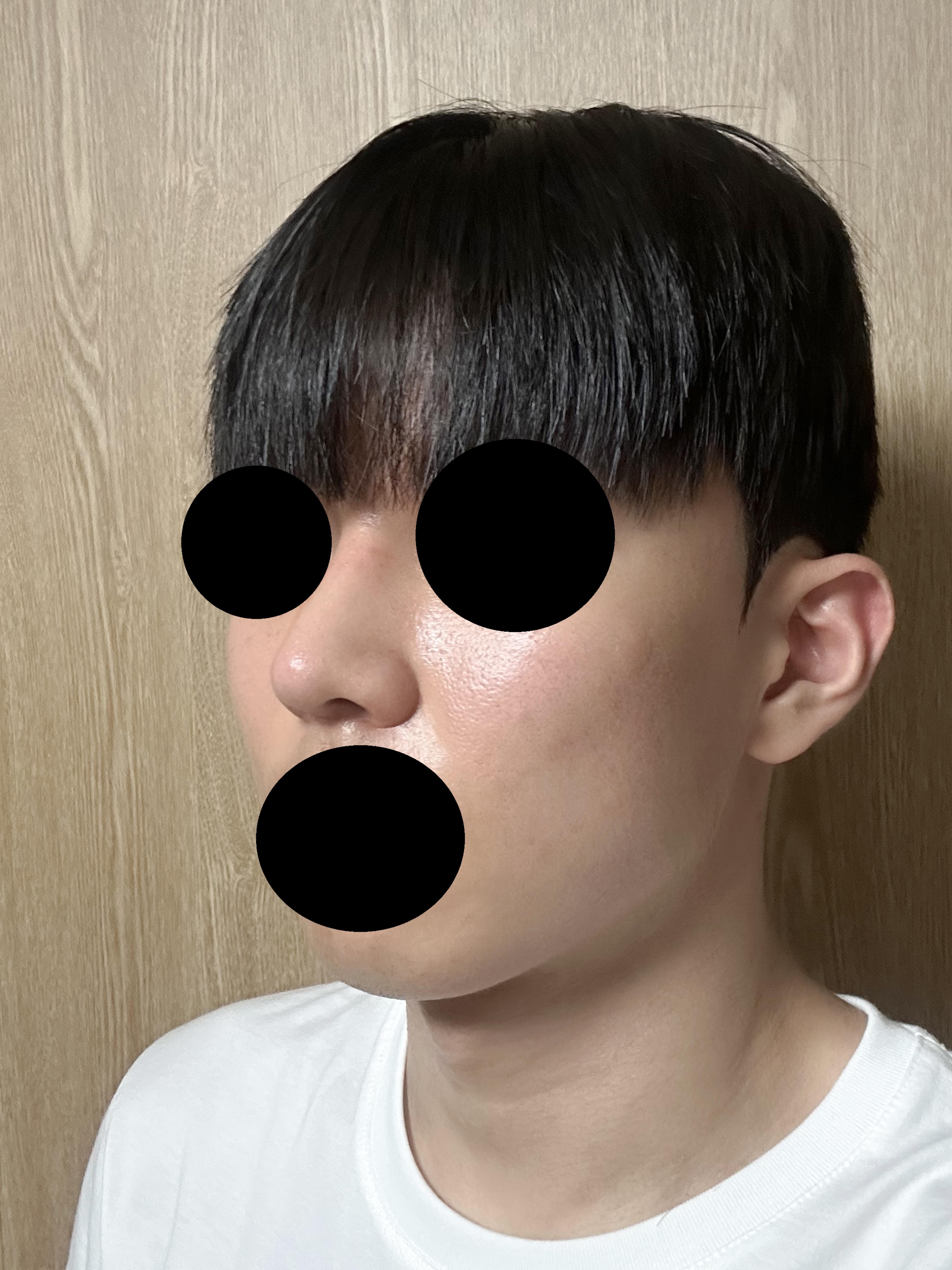 後