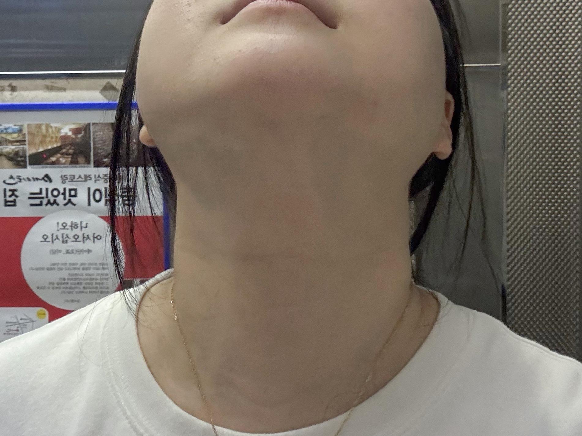 後