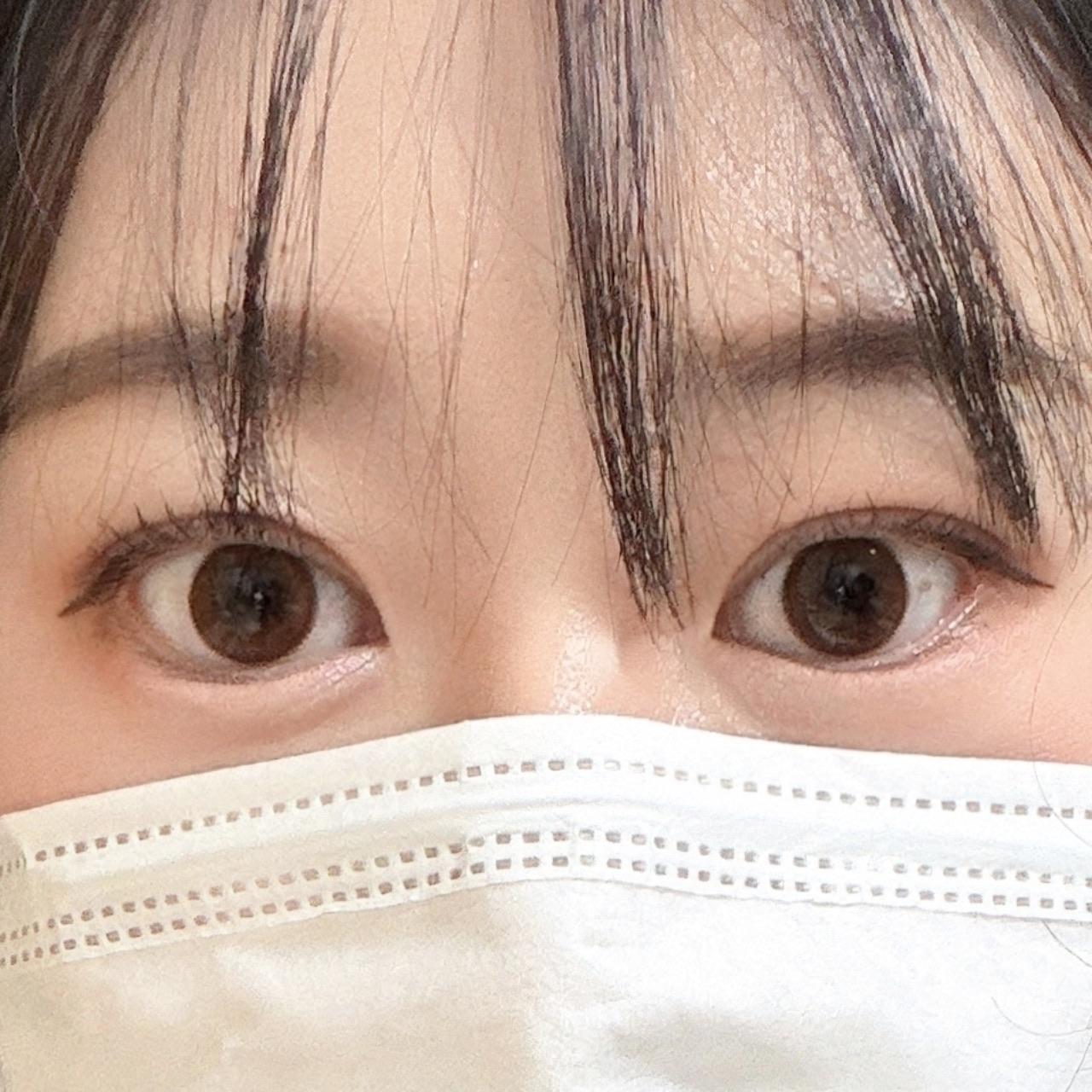 後